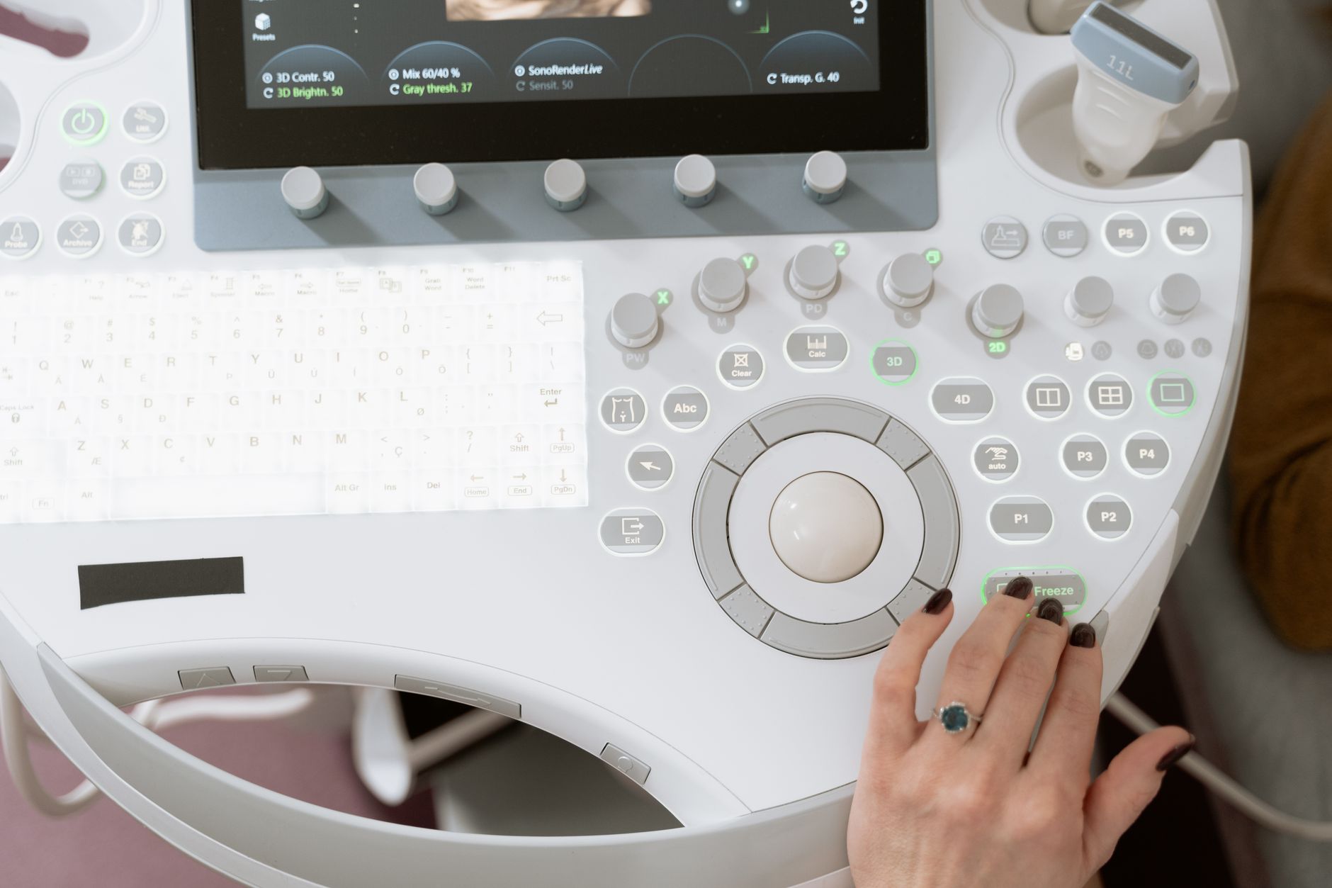 AI Tool Makes Endometriosis Diagnosis Quick and Simple